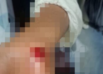 Seorang Perempuan di Ternate Jadi Korban Kekerasan, Diseret di Aspal Hingga Luka – luka