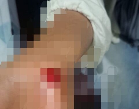 Seorang Perempuan di Ternate Jadi Korban Kekerasan, Diseret di Aspal Hingga Luka – luka